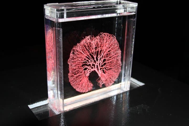 Real Bodies at Horseshoe Las Vegas: Inside the Human Anatomy Exhibition photo 2