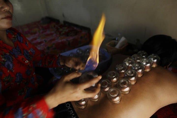 Siem Reap Khmer Wellness: Cupping, Incense Making & Blessing Experience
