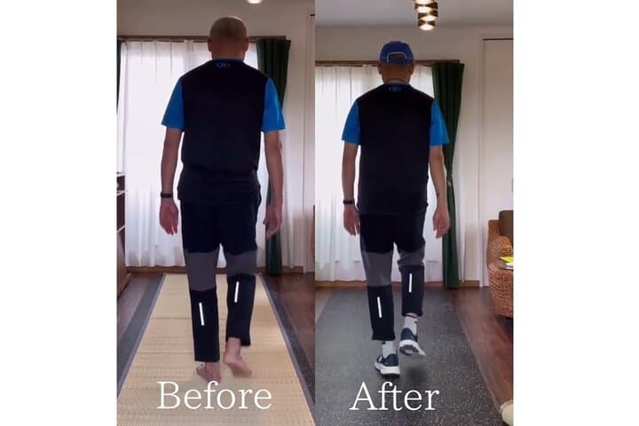 Samurai Insoles Japan: Same-Day Custom Orthotics in Narita photo 4