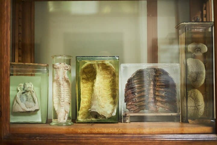 Inside Edinburgh's Surgeons' Hall Museums: Private Guided Tour & Tickets photo 5